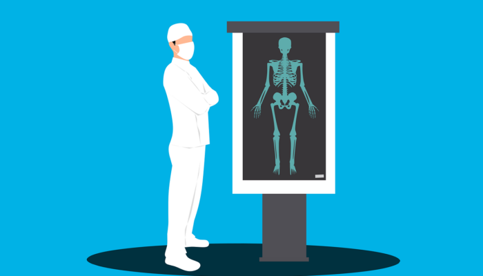 4 Tips Mencegah Penurunan Kepadatan Tulang di Usia 30an